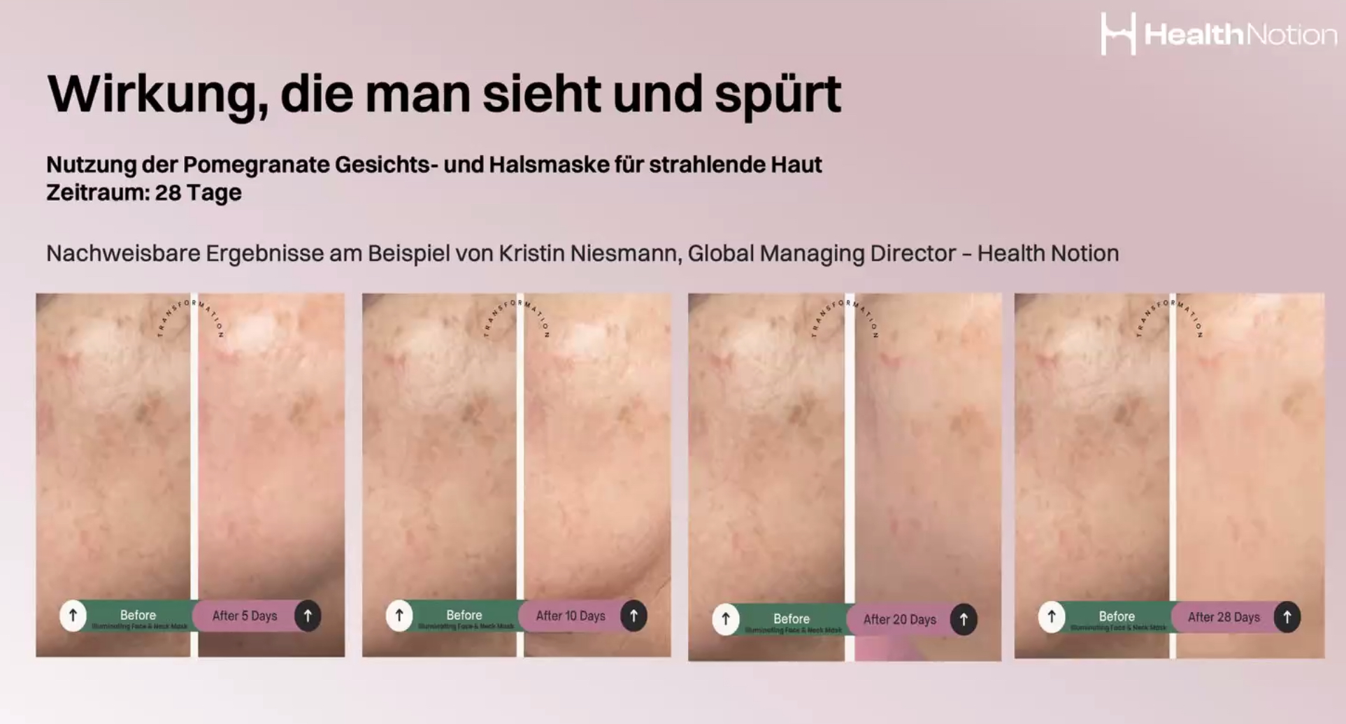 LeVannei_Granatapfel_Erfahrungen_Bilder_Anwendung